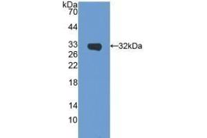 Detection of Recombinant SIRT5, Mouse using Polyclonal Antibody to Sirtuin 5 (SIRT5) (SIRT5 anticorps  (AA 37-310))