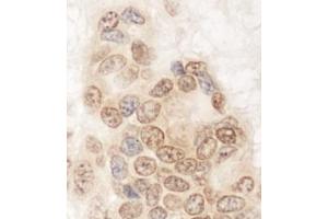 Immunohistochemistry (IHC) image for anti-Glutamine and serine Rich 1 (QSER1) (AA 175-225) antibody (ABIN7453768) (QSER1 anticorps  (AA 175-225))