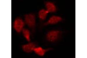 ABIN6274601 staining HepG2 by IF/ICC. (CDH22 anticorps  (N-Term))