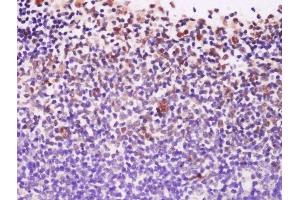 Formalin-fixed and paraffin embedded mouse lymph node labeled with Anti-EXOSC10/PMSCL2 Polyclonal Antibody, Unconjugated  at 1:200 followed by conjugation to the secondary antibody and DAB staining.