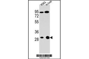 Western blot analysis in K562 cell line and mouse liver tissue lysates (35ug/lane). (ETFA anticorps  (C-Term))