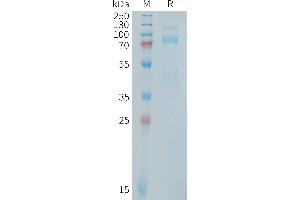 Met Proto-Oncogene (MET) (AA 25-932) protein (Fc Tag)