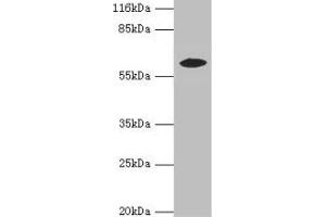Western blot All lanes: EPHX2 antibody at 2 μg/mL + MCF-7 whole cell lysate Secondary Goat polyclonal to rabbit IgG at 1/10000 dilution Predicted band size: 63, 58, 56 kDa Observed band size: 58 kDa (EPHX2 anticorps  (AA 1-555))