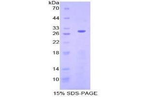SDS-PAGE analysis of Human Neurofibromin 2 Protein. (Merlin Protéine)