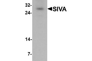 Western blot analysis of SIVA in mouse liver tissue lysate with SIVA antibody at 1 µg/mL.