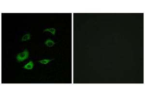 Immunofluorescence analysis of HepG2 cells, using Cyclosome 1 antibody. (APC1 anticorps  (Internal Region))