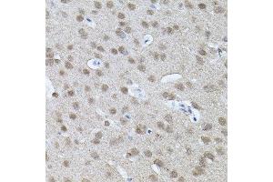 Immunohistochemistry of paraffin-embedded mouse brain using RNF166 antibody. (RNF166 anticorps)