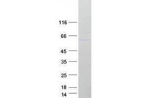 Validation with Western Blot
