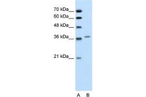 Western Blotting (WB) image for anti-Aminolevulinate Dehydratase (ALAD) antibody (ABIN2462446) (ALAD anticorps)