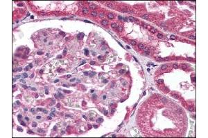 Immunohistochemistry (IHC) image for anti-Collagen, Type XVIII, alpha 1 (COL18A1) (Chain alpha 1) antibody (ABIN400737)