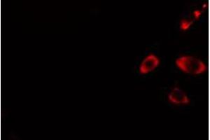 ABIN6274440 staining HuvEc cells by IF/ICC. (RIN3 anticorps  (Internal Region))