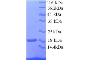 SDS-PAGE (SDS) image for Hemoglobin, alpha 1 (HBA1) (AA 2-142) protein (His tag) (ABIN5713500)