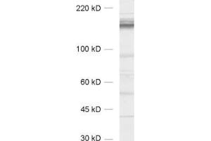 Western Blotting (WB) image for anti-CAP-GLY Domain Containing Linker Protein 1 (CLIP1) (AA 1283-1438) antibody (ABIN1742487) (CLIP1 anticorps  (AA 1283-1438))