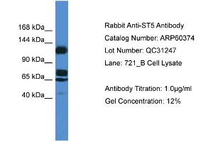 Western Blotting (WB) image for anti-Suppression of Tumorigenicity 5 (ST5) (Middle Region) antibody (ABIN2788427) (ST5 anticorps  (Middle Region))