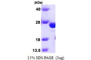 SDS-PAGE (SDS) image for Glutathione S-Transferase kappa 1 (GSTK1) (AA 1-226) protein (ABIN666936) (GSTK1 Protein (AA 1-226))
