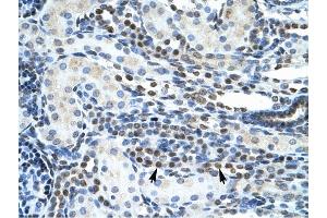 Immunohistochemistry (IHC) image for anti-GS Homeobox 2 (GSX2) (N-Term) antibody (ABIN2779505)