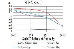 Black line: Control Antigen (100 ng), Purple line: Antigen(10 ng), Blue line: Antigen (50 ng), Red line: Antigen (100 ng),