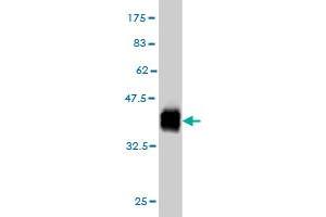 Western Blot detection against Immunogen (37. (ZNF41 anticorps  (AA 221-321))