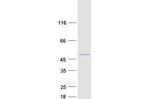 Validation with Western Blot