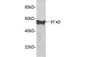 Western blot analysis of recombinant human PIN1 protein using 1 µg/mL Rabbit Anti-PIN1 Polyclonal Antibody (ABIN398689) The signal was developed with IRDyeTM 800 Conjugated Goat Anti-Rabbit IgG (PIN1 anticorps  (AA 50-100))