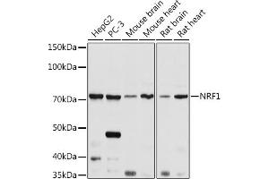 Western blot analysis of extracts of various cell lines, using NRF1 antibody (ABIN6128358, ABIN6144851, ABIN6144853 and ABIN6221193) at 1:1000 dilution.