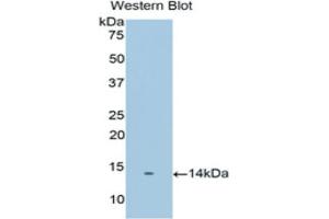 Western blot analysis of the recombinant protein. (PSCA anticorps  (AA 22-123))