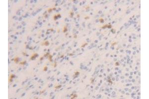 Detection of CASP1 in Human Spleen Tissue using Polyclonal Antibody to Caspase 1 (CASP1)