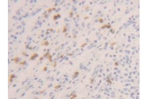 Detection of CASP1 in Human Spleen Tissue using Polyclonal Antibody to Caspase 1 (CASP1) (Caspase 1 anticorps  (AA 120-297))