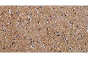 Immunohistochemistry of paraffin-embedded Human brain using GAB2 Polyclonal Antibody at dilution of 1:40 (GAB2 anticorps)