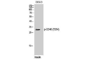 Western Blotting (WB) image for anti-CD40 (CD40) (pThr254) antibody (ABIN3179550) (CD40 anticorps  (pThr254))