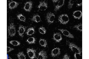 Immunofluorescent staining of A549 (ATCC CCL-185) cells. (HSPD1 anticorps)