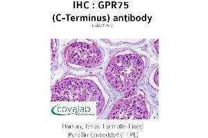 Image no. 2 for anti-G Protein-Coupled Receptor 75 (GPR75) (C-Term) antibody (ABIN1735162) (GPR75 anticorps  (C-Term))