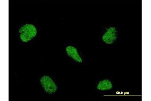 Immunofluorescence of monoclonal antibody to RBM5 on HeLa cell.