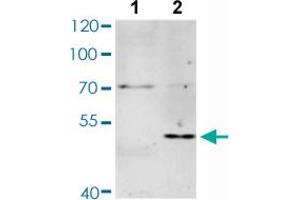 Western blot analysis of Lane 1: Untreated Jurkat cells, Lane 2: Starvation treated Jurkat cells with MAX (phospho S11) polyclonal antibody  at 1:500-1:2000 dilution. (MAX anticorps  (pSer11))