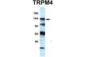 Host:  Rabbit  Target Name:  TRPM4  Sample Type:  721_B  Antibody Dilution:  1.