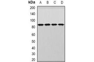 Western blot analysis of DDX1 expression in MCF7 (A), HepG2 (B), mouse brain (C), rat brain (D) whole cell lysates. (DDX1 anticorps)