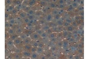 Detection of OC in Mouse Liver Tissue using Polyclonal Antibody to Osteocalcin (OC)