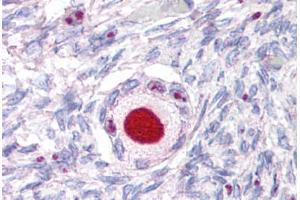 Anti-NR5A1 antibody  ABIN1049145 IHC staining of human ovary. (NR5A1 anticorps  (Internal Region))