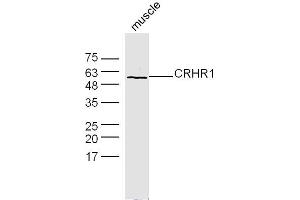Mouse muscle lysates probed with CRHR1 Polyclonal Antibody, Unconjugated  at 1:300 dilution and 4˚C overnight incubation. (CRHR1 anticorps  (AA 55-150))