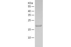 Western Blotting (WB) image for Retinoschisin 1 (RS1) (AA 24-224) protein (His-IF2DI Tag) (ABIN7124855)
