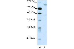 WB Suggested Anti-TRIM28  Antibody Titration: 1. (KAP1 anticorps  (C-Term))