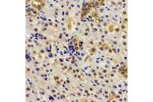 Immunohistochemical analysis of Deltex-2 staining in human kidney formalin fixed paraffin embedded tissue section. (DTX2 anticorps)