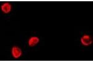 Immunofluorescent analysis of TCF4 staining in Hela cells. (TCF4 anticorps)