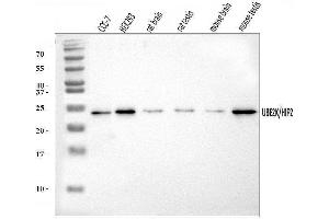 Western blot analysis of HIP2/LIG/UBE2K using anti-HIP2/LIG/UBE2K antibody (ABIN7601341).