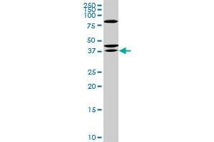 RDHE2 monoclonal antibody (M01), clone 3G8. (SDR16C5 anticorps  (AA 26-309))