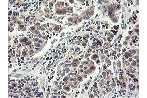 anti-NIF3 NGG1 Interacting Factor 3-Like 1 (NIF3L1) antibody