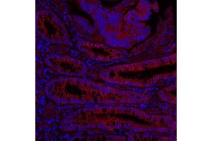 Immunofluorescence (IF) image for anti-Poliovirus Receptor-Related 2 (Herpesvirus Entry Mediator B) (PVRL2) (AA 50-100) antibody (ABIN7449542)