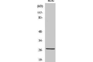Western Blotting (WB) image for anti-Acidic (Leucine-Rich) Nuclear phosphoprotein 32 Family, Member C (ANP32C) (Internal Region) antibody (ABIN6285341)