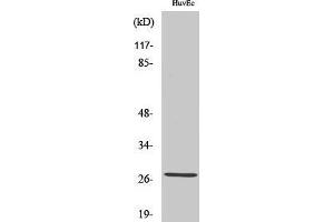 Western Blotting (WB) image for anti-Acidic (Leucine-Rich) Nuclear phosphoprotein 32 Family, Member C (ANP32C) (Internal Region) antibody (ABIN3186535)