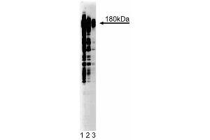 Western blot analysis of Phosphotyrosine on A431 lysate. (Phosphotyrosine anticorps)
